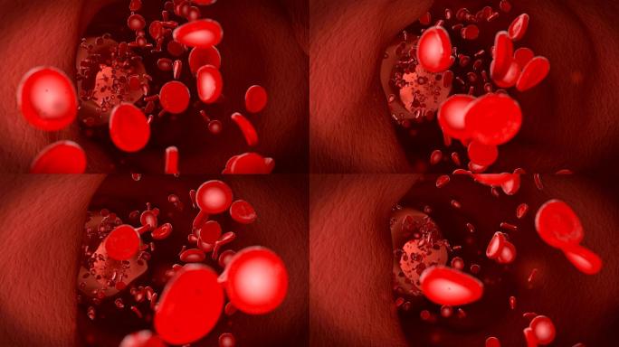 红血球红血球流经静脉