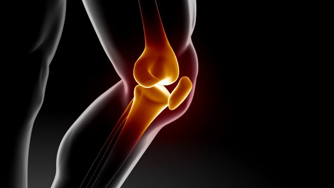 膝关节疼痛及其治疗效果