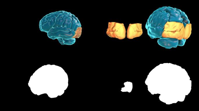 人脑图谱动画放疗诊断医疗扫描仪CT医学图