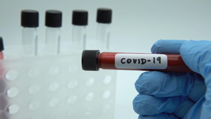 实验室技术员手持式血样管，用于冠状病毒检测