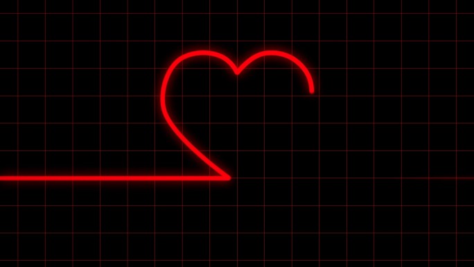心电图上的心跳显示心脏形状
