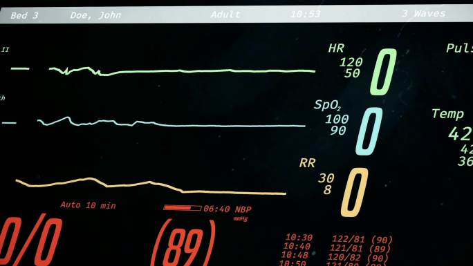 带患者生命体征的内科ICU监护仪