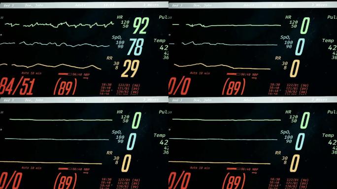 带患者生命体征的内科ICU监护仪