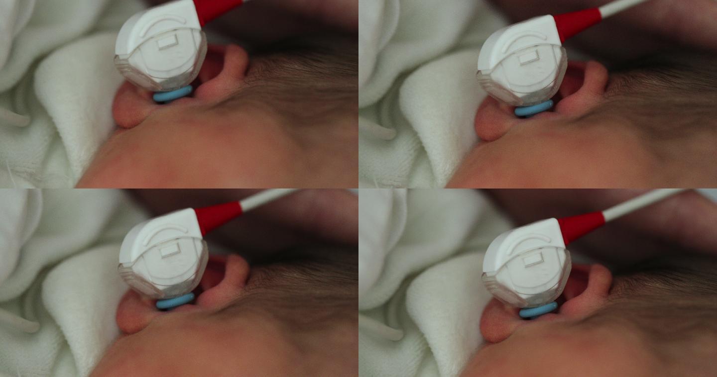 新生儿耳检，医生检查婴儿