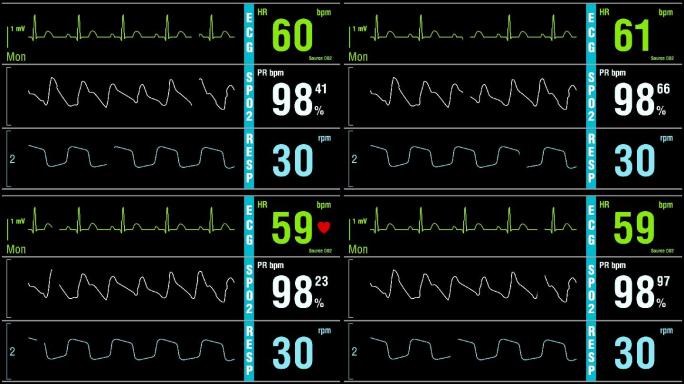 患者监护仪显示体检生命体征