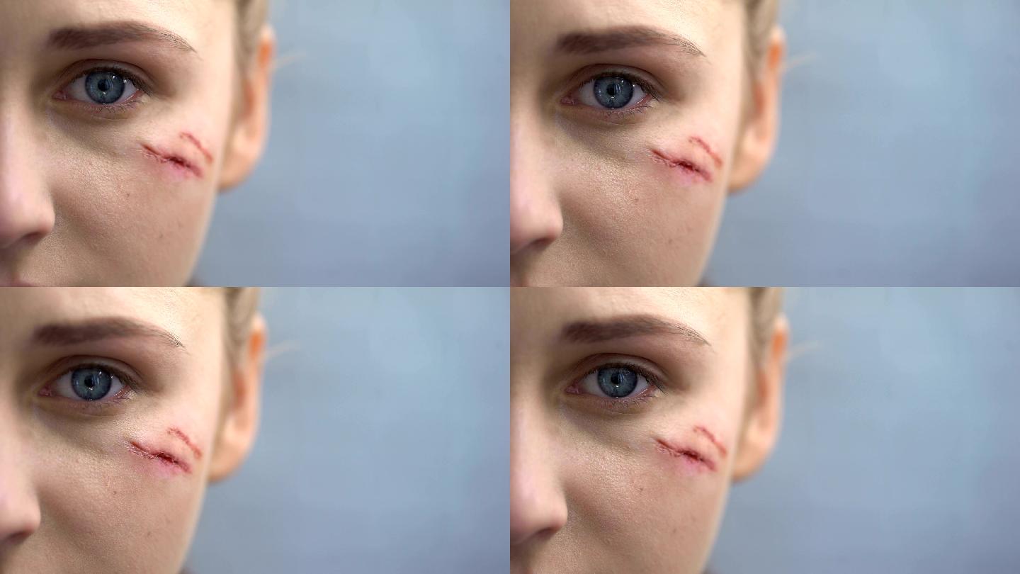 面对镜头,脸上有伤疤的女性画质检查举报作品下载小样0声明水印不代表