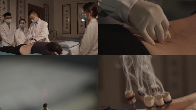 4k中医艾灸三伏灸传统中医传承