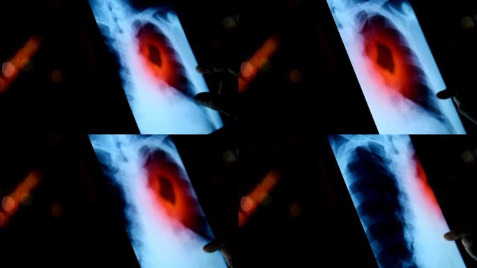 肺扫描医疗扫描仪干细胞主题医学