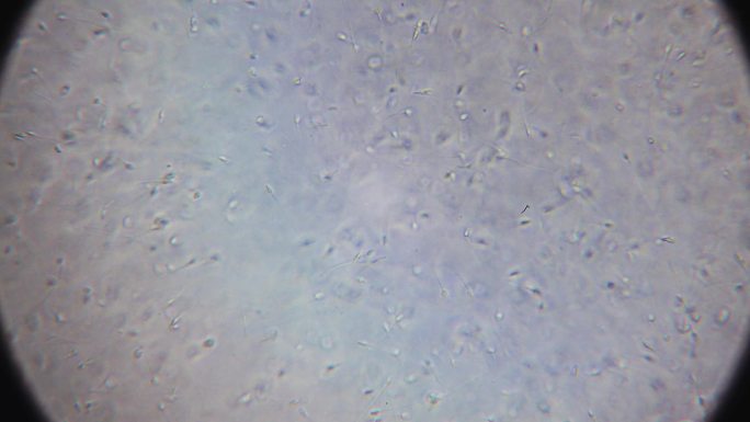 6K-显微镜下的精子