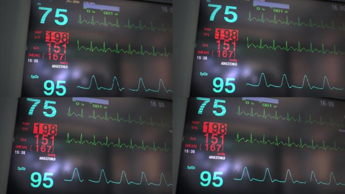 生命体征监护仪波形医疗器械医疗保健和医学