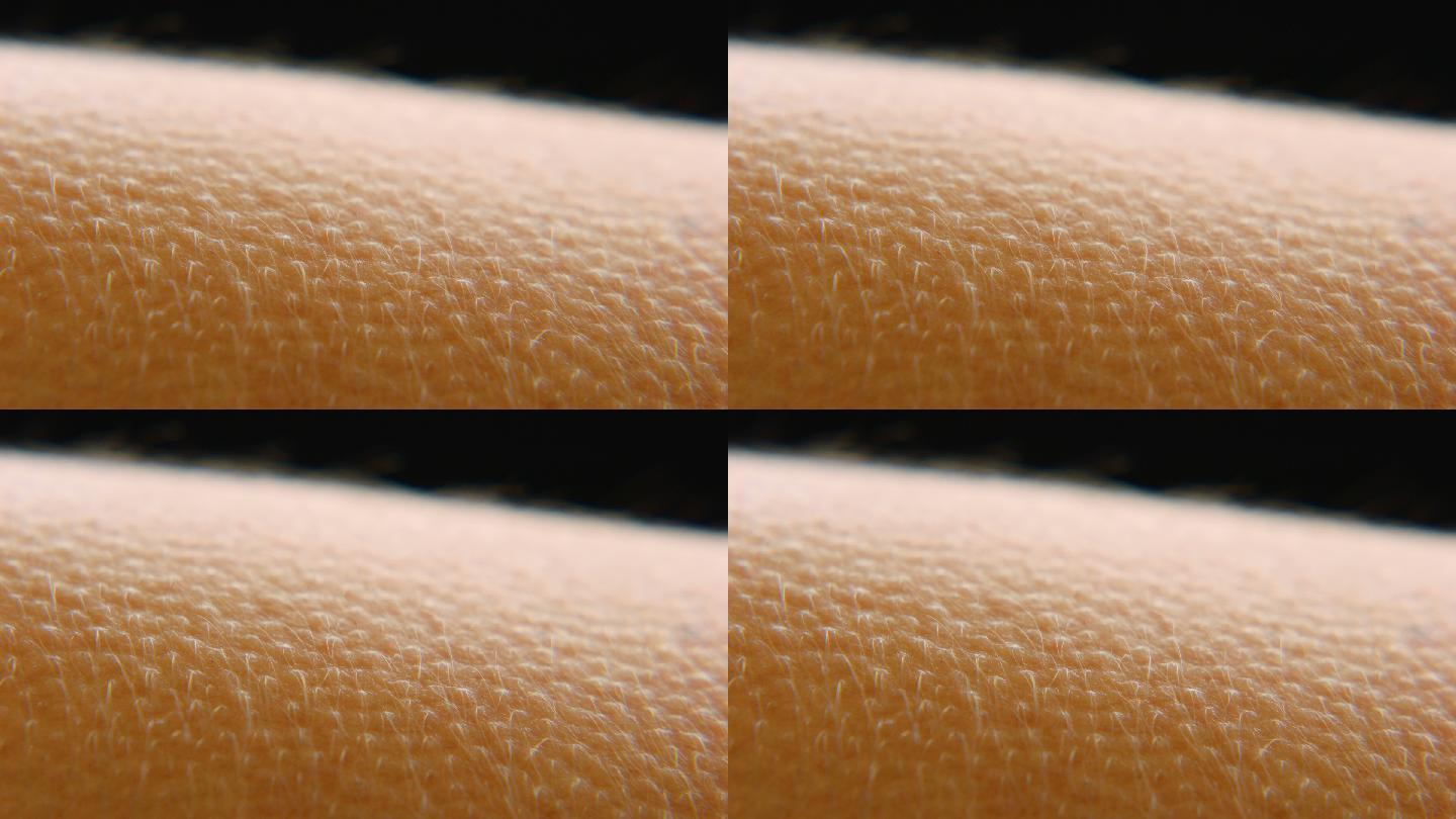 脖子上鸡皮疙瘩的原因(脖子上鸡皮疙瘩的原因图片) 脖子上鸡皮疙瘩的原因(脖子上鸡皮疙瘩的原因图片)