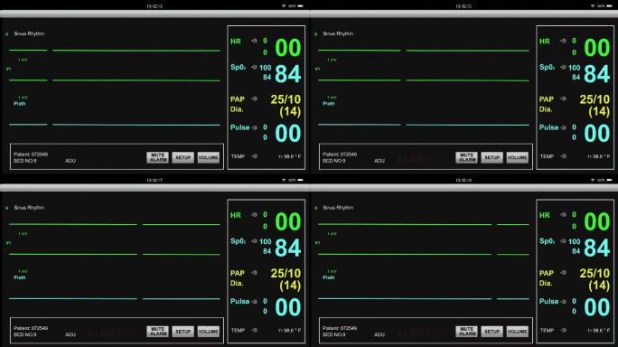 EKG患者心脏监护仪在医院的平面急救