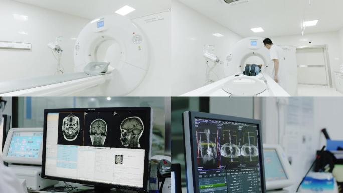 高端医疗设备CT检查全身检查体检CT扫描