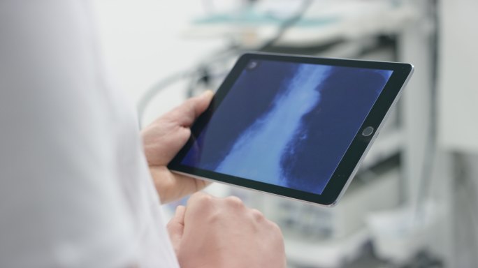 医生拿着一个平板电脑上显示的肺扫描
