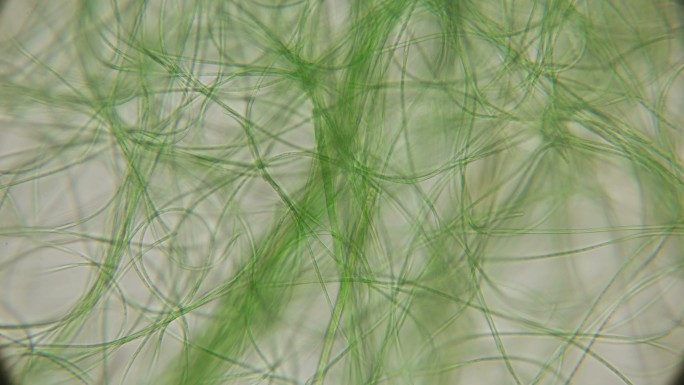 在显微镜下活动的活藻类