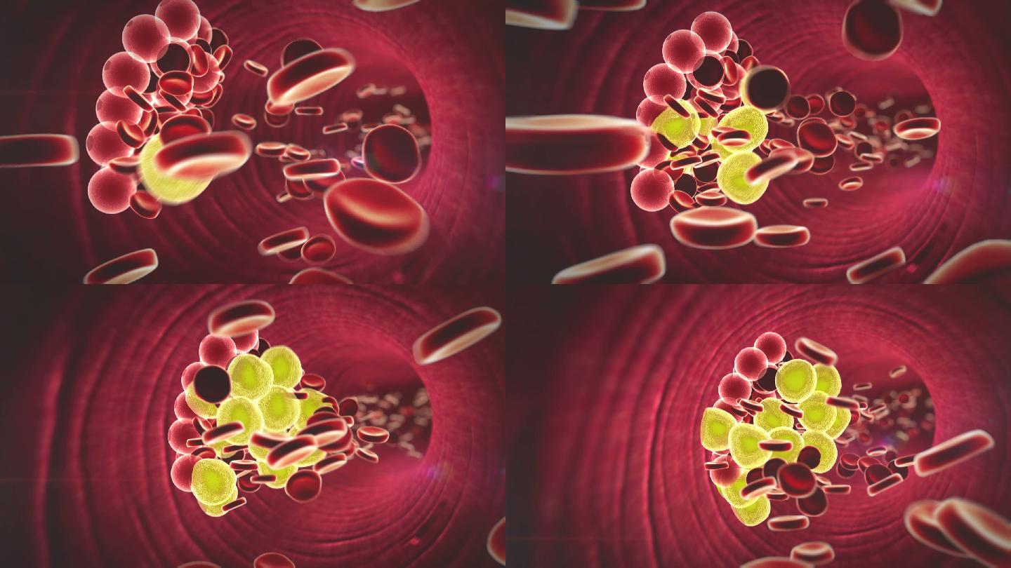 血液中的脂肪细胞和红细胞