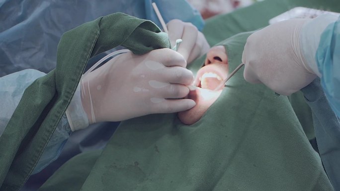 牙齿口腔种植牙手术