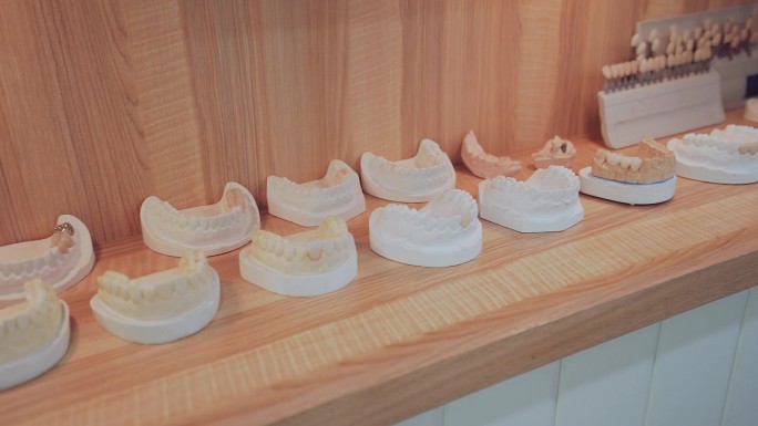牙齿模型种植牙