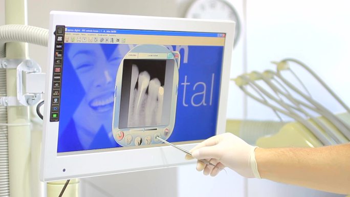 牙科办公室、设备口腔医学x光片会诊分析