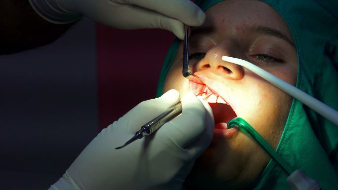 口腔外科手术