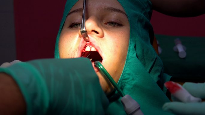 口腔牙科手术