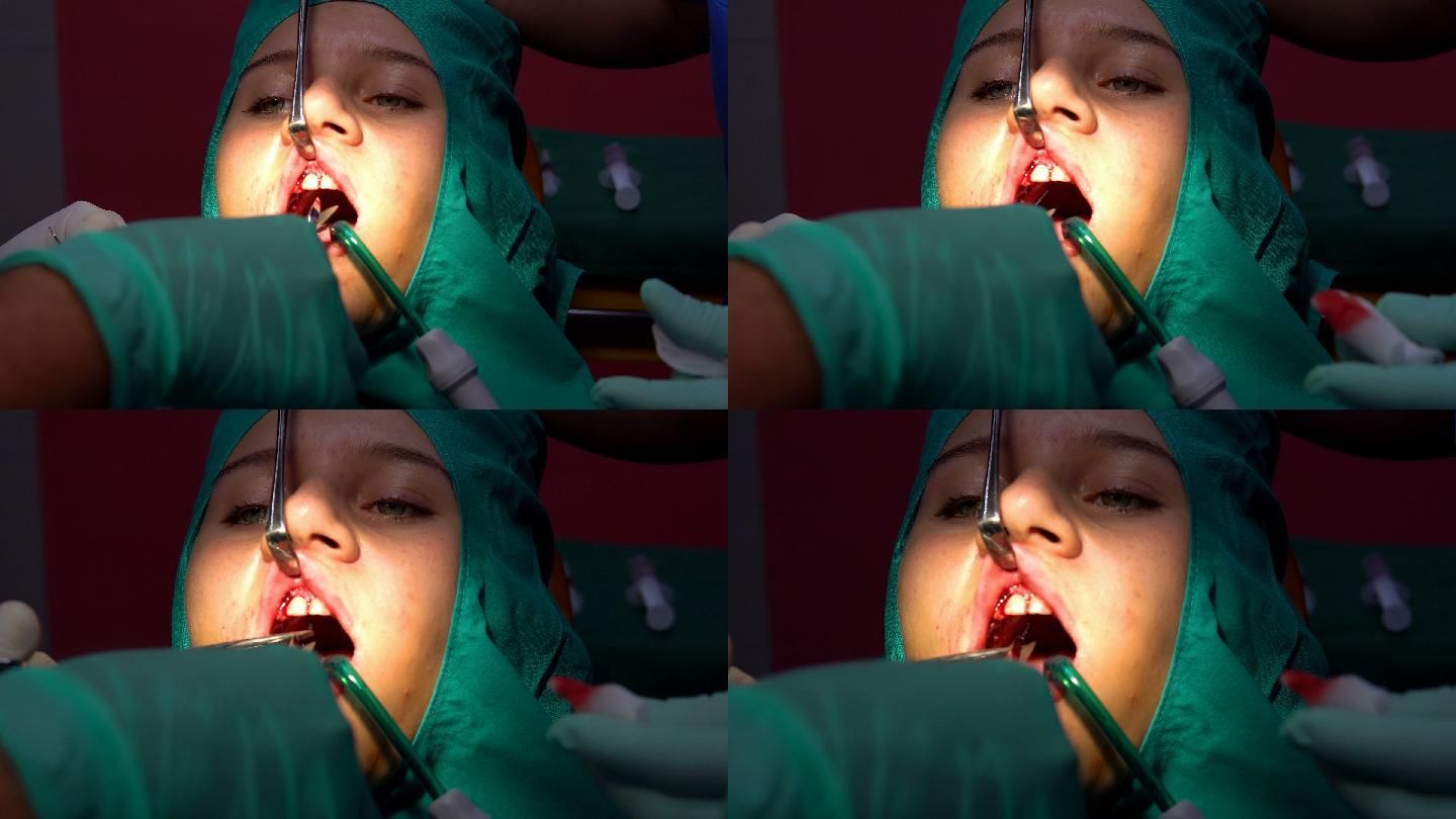 口腔牙科手术