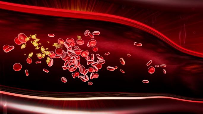 血管内凝聚成团的血红细胞血栓溶解