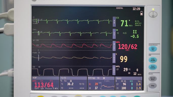 医院标准心电监护仪素材实拍