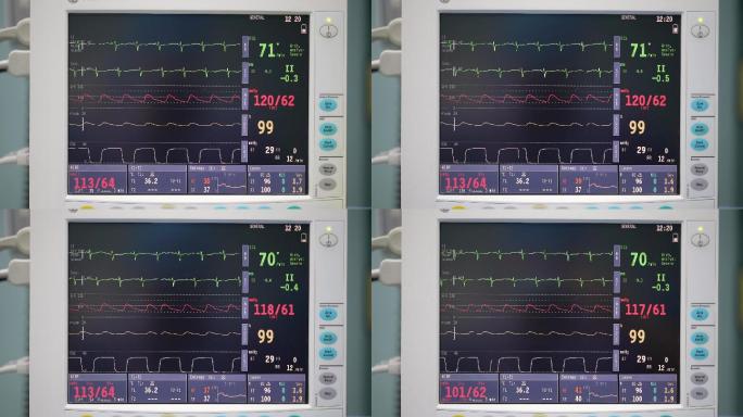 医院标准心电监护仪素材实拍