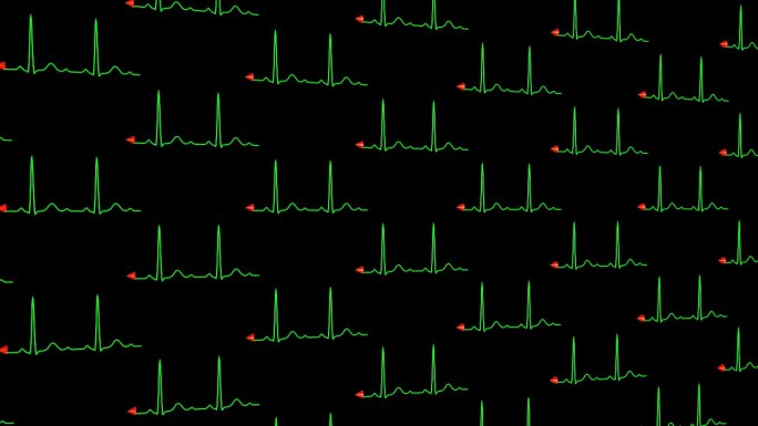 正常心电图窦性心率铺满屏幕背景03