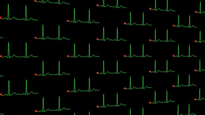 正常心电图窦性心率铺满屏幕背景04