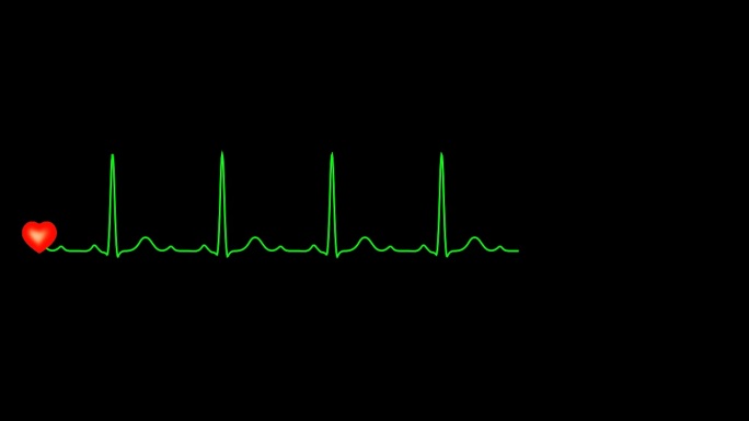 正常心电图窦性心率01