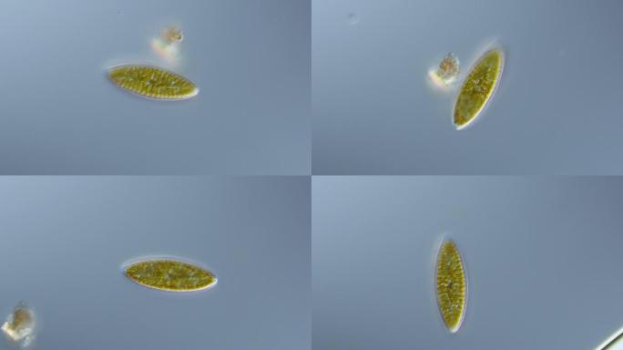 硅藻-双棱藻属-400倍