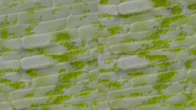 叶绿体-DIC-1000倍