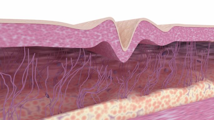 除皱治疗。抗衰老护肤品。医学3D动画。