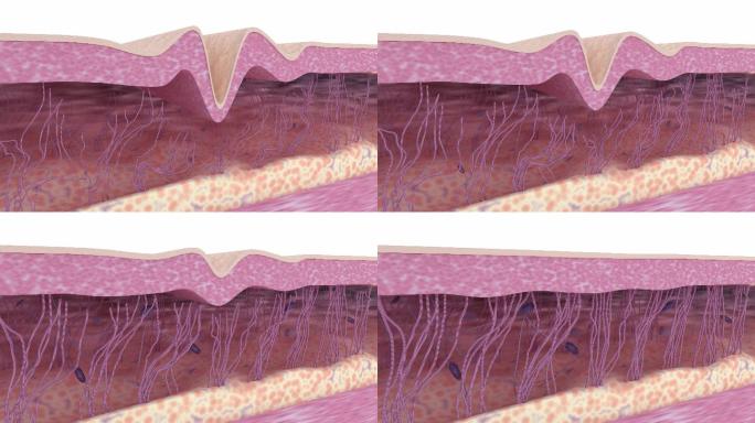 除皱治疗。抗衰老护肤品。医学3D动画。