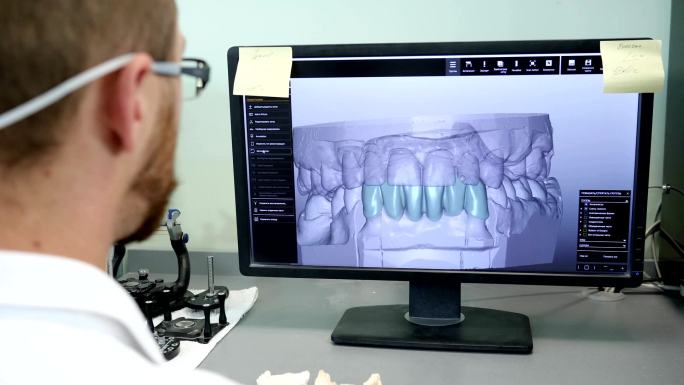 牙科医生在工作口腔科放射科断面三维立体