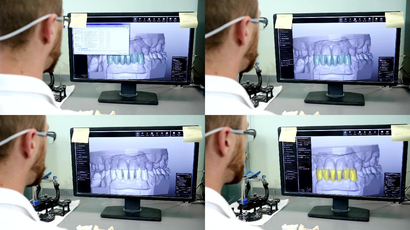 牙科医生在工作口腔科放射科断面三维立体