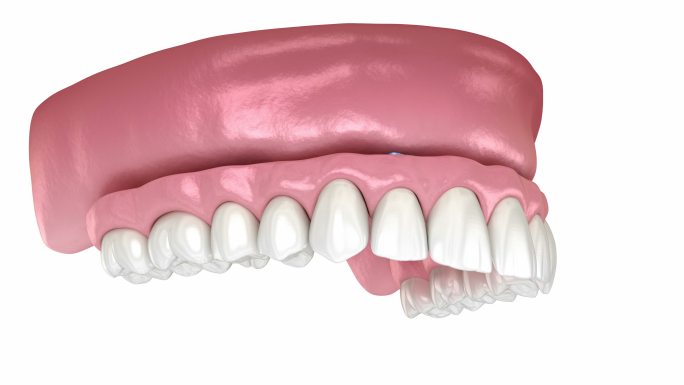 人体牙齿