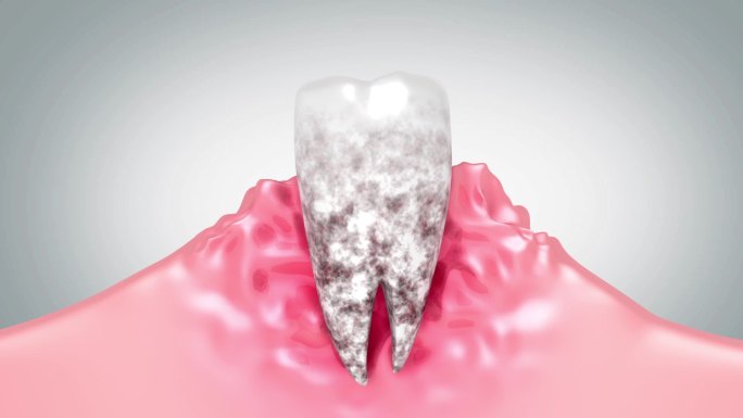 修复牙齿牙龈