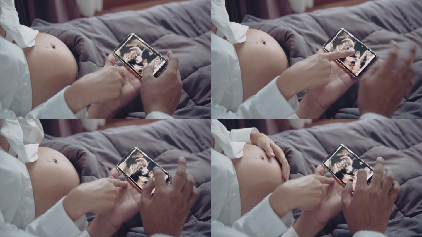 怀孕胎儿怀孕
