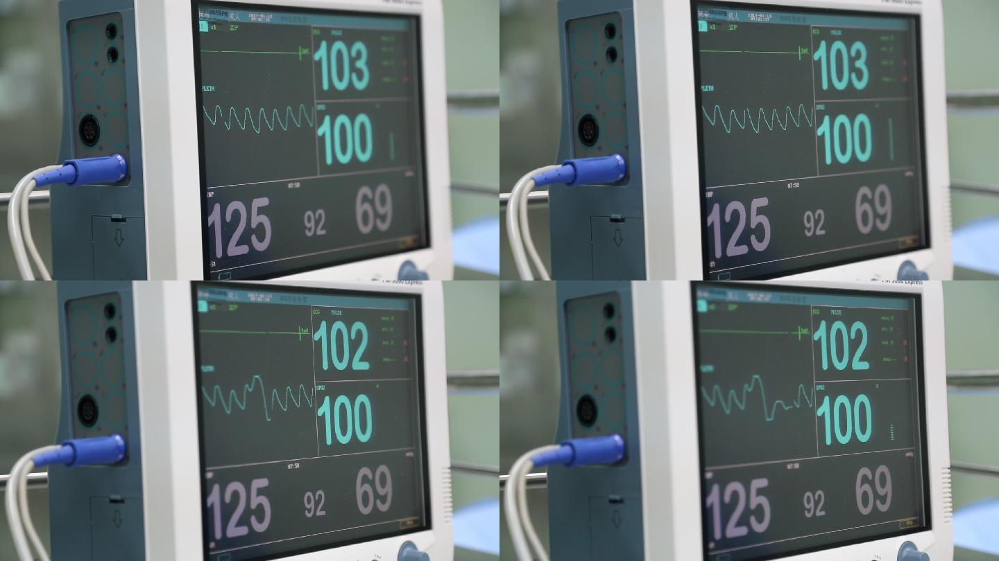 手术 心跳 仪器  抢救 病人 ICU