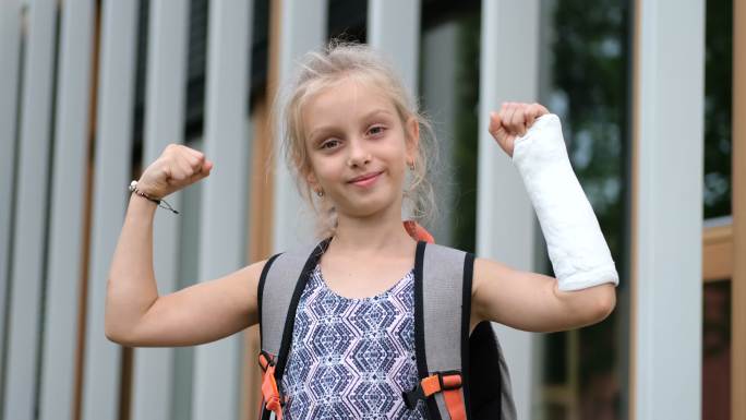 手臂骨折的女孩戴着矫形石膏。