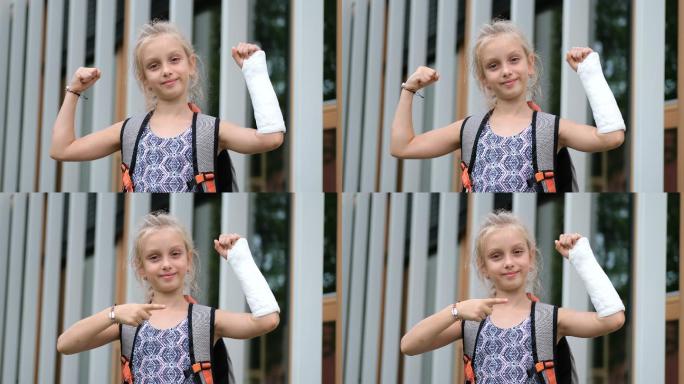 手臂骨折的女孩戴着矫形石膏。