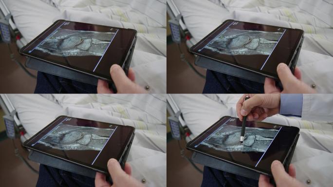骨科医生在数字平板电脑上查看x射线图像