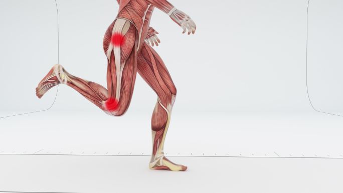 跑步者的肌肉疼痛身体部位特效视频