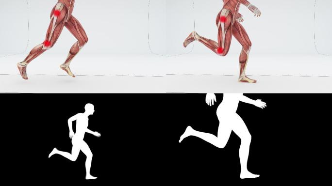 跑步者的肌肉疼痛身体部位特效视频