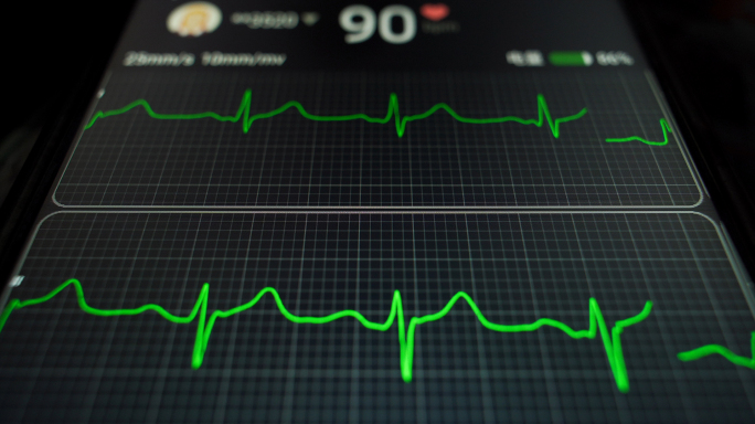 家庭医疗心电图测量