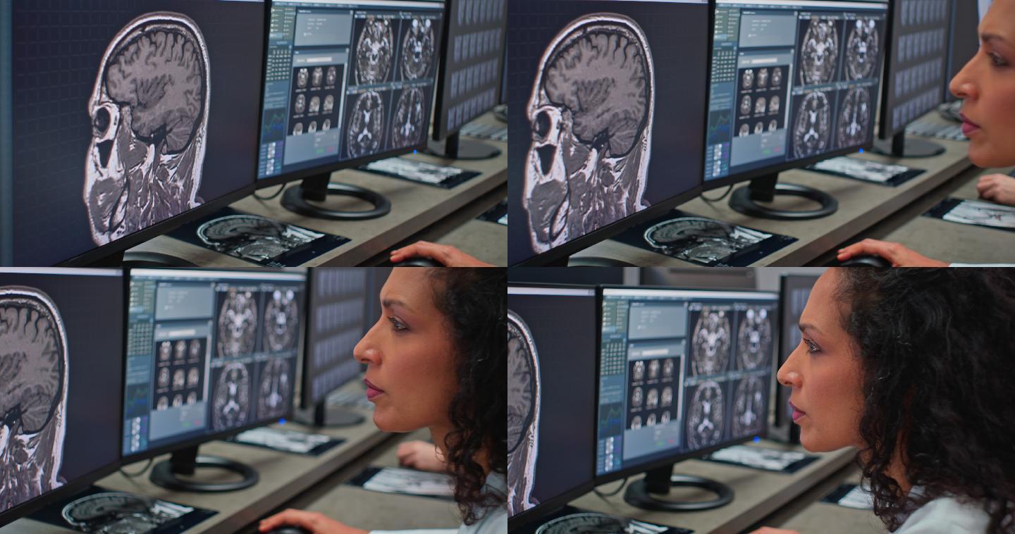 放射科医生正在分析头部MRI扫描