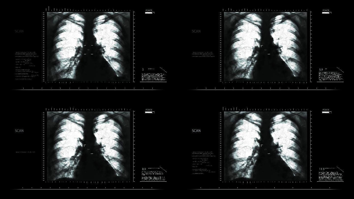 胸部x光片，显示肺、心脏和肋骨照片摄影图片_ID:139199467-Veer图库